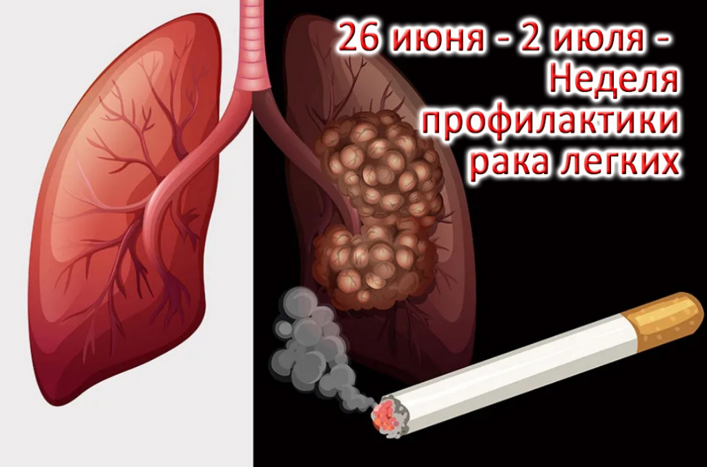 PRO рак. Почему рак легких так сложно лечить? | Блог luchistii-sudak.ru | Дзен